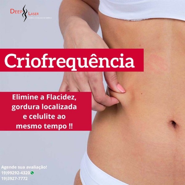 criofrequencia