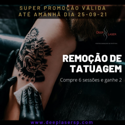 Saúde e beleza - Remoção de Tatuagem a Laser  - Remoção de Tatuagem a Laser 