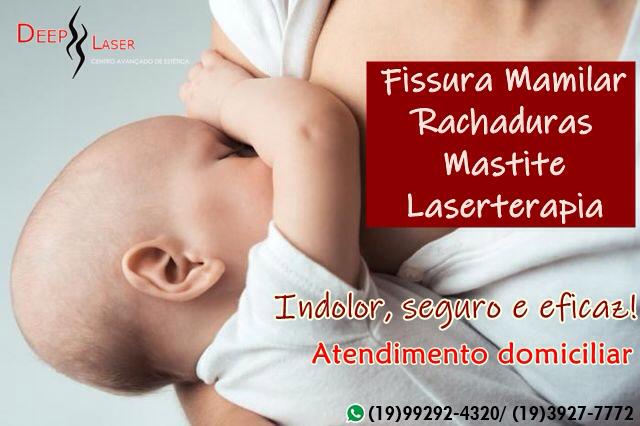 tratamento-fissura-mamilar-mastite