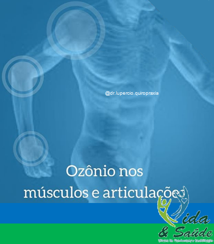 ozonioterapia-muscular-ipeuna-saltinho-aguas-de-sao-pedro