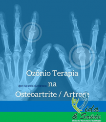 OZONIOTERAPIA 