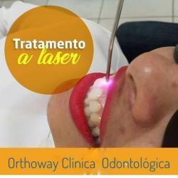 Tratamento Odontológico a Laser