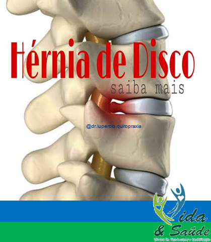 hernia-de-disco-itapetininga-botucatu-jau