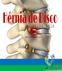 HERNIA DE DISCO 