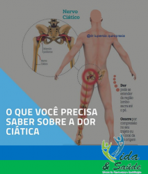 DOR CIÁTICA