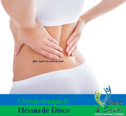 OZONIOTERAPIA PARA HERNIA DE DISCO 