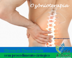 Ozonioterapia 