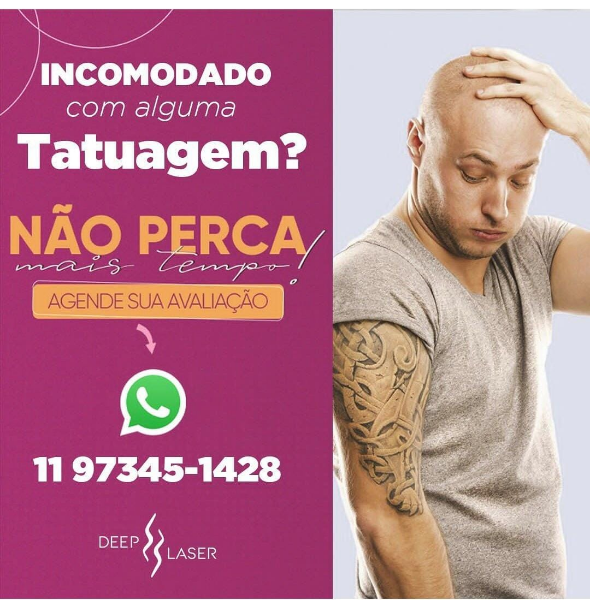 remocao-laser-de-tatuagem-Jundiaí