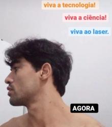 Remoção laser de Tatuagem - Jardins - São Paulo