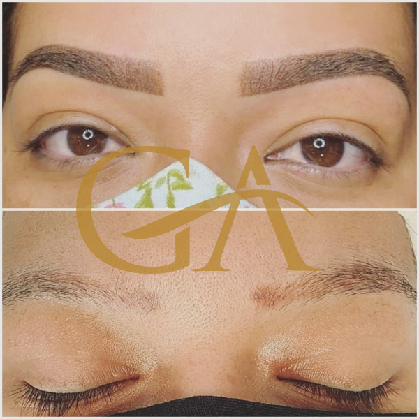 remocao-de-microblading-micropigmentacao-de-sobrancelhas-