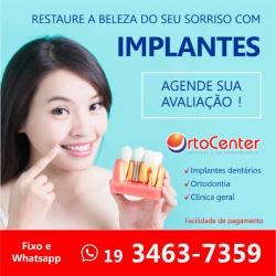 Implante dentário sbo americana