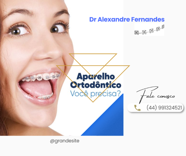 Aparelhos Ortodônticos 