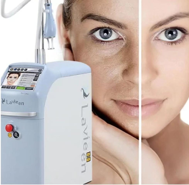 rejuvenescimento-facial-tratamento-de-marcas-de-expressao-laser-harmony-piracicaba