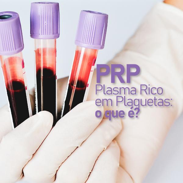 prp-plasma-rico-em-proteinas-plaquetas-para-tratar-a-dor-sao-pedro-rio-das-pedras-americana-sbo