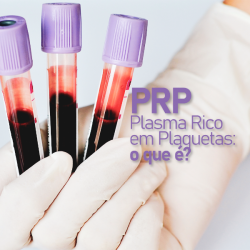 PRP Plasma Rico em Proteínas para Tratar a Dor 