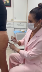 Harmonização de Glúteos 