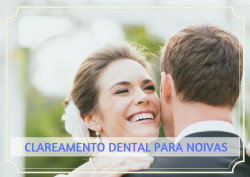 Saúde e beleza - CLAREAMENTO DENTAL PARA NOIVAS - CLAREAMENTO DENTAL PARA NOIVAS