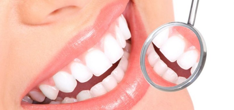 profilaxia-limpeza-e-raspagem-dentaria-