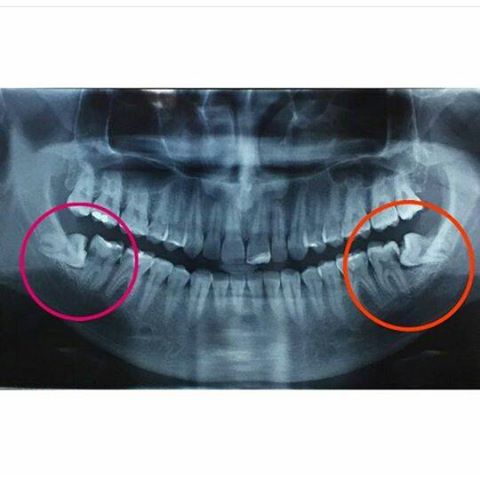 siso-cirurgia