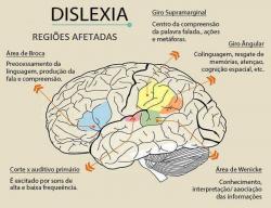 Serviços - Dislexia - Dislexia